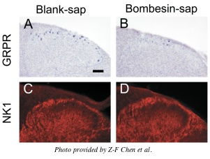 Bombesin-SAP