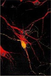 Targeted Therapy for Chronic Pain IT-07