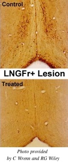 LNGFr+ Lesion